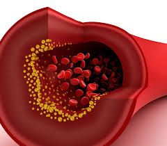 Nativa Farmcia e Manipulao O colesterol é considerado um tipo de “gordura” produzido pelo organismo. Ele desempenha funções essenciais, como produção de hormônios e vitamina D. Entretanto,...